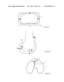 SYSTEM FOR DETERMINING THE POSITION OF A KNEE PROSTHESIS diagram and image