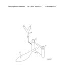 SYSTEM FOR DETERMINING THE POSITION OF A KNEE PROSTHESIS diagram and image