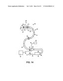 APPARATUS AND METHOD FOR ENDOSCOPIC COLECTOMY diagram and image