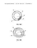 APPARATUS AND METHOD FOR ENDOSCOPIC COLECTOMY diagram and image