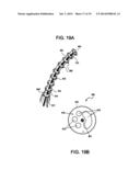 APPARATUS AND METHOD FOR ENDOSCOPIC COLECTOMY diagram and image