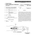 PERCUTANEOUS FLARING HAMMERTOE FIXATION IMPLANT AND INSTRUMENT diagram and image