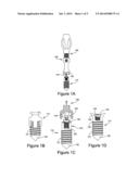 PERCUTANEOUS FLARING HAMMERTOE FIXATION IMPLANT AND INSTRUMENT diagram and image