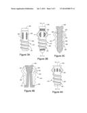 PERCUTANEOUS FLARING HAMMERTOE FIXATION IMPLANT AND INSTRUMENT diagram and image