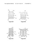 PERCUTANEOUS FLARING HAMMERTOE FIXATION IMPLANT AND INSTRUMENT diagram and image