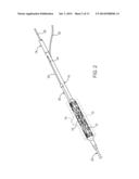 APPARATUS AND METHODS FOR DELIVERING PROSTHESES TO LUMINAL BIFURCATIONS diagram and image