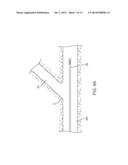 APPARATUS AND METHODS FOR DELIVERING PROSTHESES TO LUMINAL BIFURCATIONS diagram and image