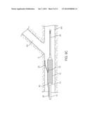 APPARATUS AND METHODS FOR DELIVERING PROSTHESES TO LUMINAL BIFURCATIONS diagram and image