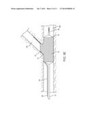 APPARATUS AND METHODS FOR DELIVERING PROSTHESES TO LUMINAL BIFURCATIONS diagram and image