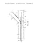 APPARATUS AND METHODS FOR DELIVERING PROSTHESES TO LUMINAL BIFURCATIONS diagram and image