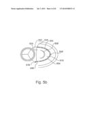 METHOD AND APPARATUS FOR CATHETER-BASED ANNULOPLASTY USING LOCAL     PLICATIONS diagram and image