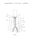 EXPANDABLE ILIAC SHEATH AND METHOD OF USE diagram and image