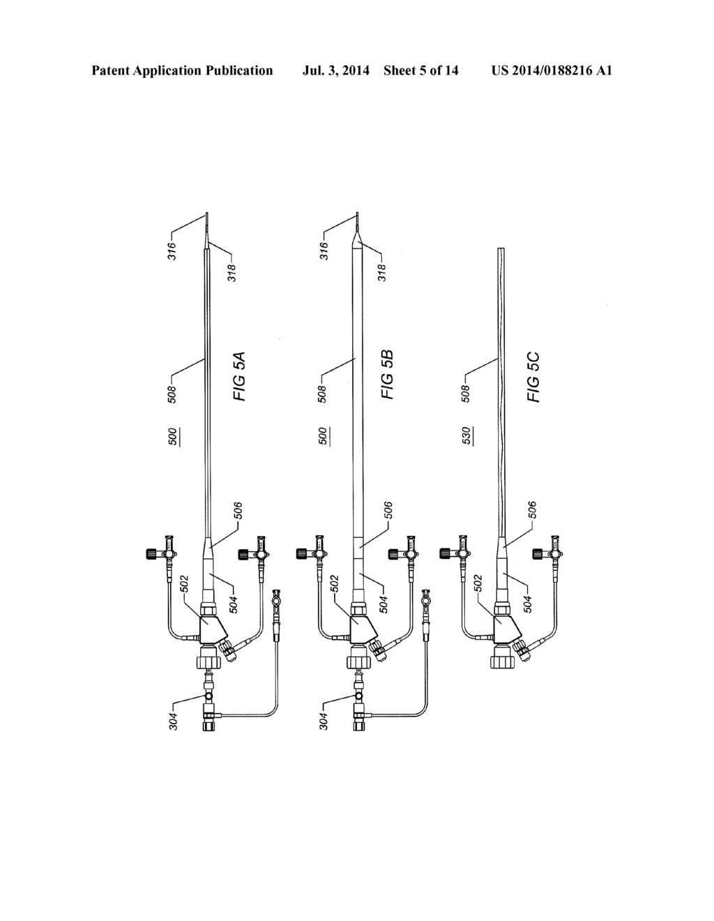 EXPANDABLE ILIAC SHEATH AND METHOD OF USE - diagram, schematic, and image 06