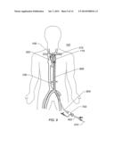 EXPANDABLE ILIAC SHEATH AND METHOD OF USE diagram and image