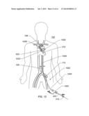 EXPANDABLE ILIAC SHEATH AND METHOD OF USE diagram and image