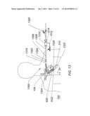 EXPANDABLE ILIAC SHEATH AND METHOD OF USE diagram and image