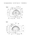 Implantable biological joint replacement diagram and image