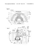 Implantable biological joint replacement diagram and image