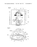 Implantable biological joint replacement diagram and image