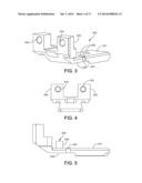 ANKLE REPLACEMENT SYSTEM AND METHOD diagram and image