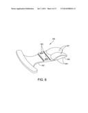 ANKLE REPLACEMENT SYSTEM AND METHOD diagram and image