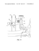 ANKLE REPLACEMENT SYSTEM AND METHOD diagram and image