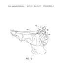 ANKLE REPLACEMENT SYSTEM AND METHOD diagram and image