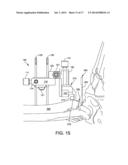 ANKLE REPLACEMENT SYSTEM AND METHOD diagram and image