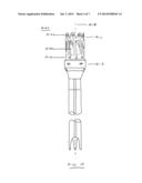 DEVICES FOR GASTROINTESTINAL BYPASS HAVING TISSUE INGROWTH FEATURES diagram and image