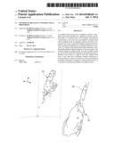 METHOD OF DIGITALLY CONSTRUCTING A PROSTHESIS diagram and image