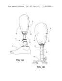 METHOD OF DIGITALLY CONSTRUCTING A PROSTHESIS diagram and image