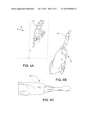 METHOD OF DIGITALLY CONSTRUCTING A PROSTHESIS diagram and image