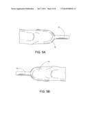 METHOD OF DIGITALLY CONSTRUCTING A PROSTHESIS diagram and image