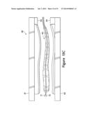 Contoured Fluid-Filled Chamber diagram and image