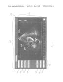 SYSTEMS AND METHODS FOR USING A TOUCH-SENSITIVE DISPLAY UNIT TO ANALYZE A     MEDICAL IMAGE diagram and image