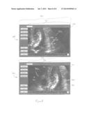 SYSTEMS AND METHODS FOR USING A TOUCH-SENSITIVE DISPLAY UNIT TO ANALYZE A     MEDICAL IMAGE diagram and image