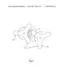 PROCESS FOR RECYCLING MULTICOMPARTMENT UNIT DOSE ARTICLES diagram and image