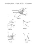 Adjustable Chin Support for Musical Instrument diagram and image