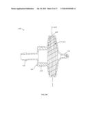 PRODUCT GAS CONCENTRATOR UTILIZING VACUUM SWING ADSORPTION AND METHOD     ASSOCIATED THEREWITH diagram and image