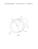 PROJECTILE ASSEMBLY WITH STABILIZATION/OBTURATION ENHANCEMENT diagram and image