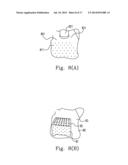 EARLY WARNING METHOD AND DEVICE FOR PREVENTING WHEELCHAIR FROM TIPPING     OVER diagram and image