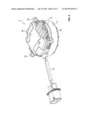 ELECTRIC MOTOR, IN PARTICULAR A RADIATOR FAN MOTOR, AND A CONTACT diagram and image