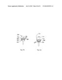 MECHANICAL BYPASS LIGHT UNIT diagram and image