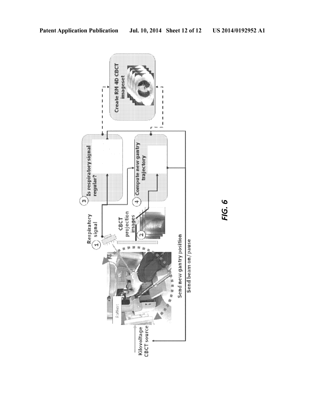 MODULATING GANTRY ROTATION SPEED AND IMAGE ACQUISITION IN RESPIRATORY     CORRELATED (4D) CONE BEAM CT IMAGES - diagram, schematic, and image 13