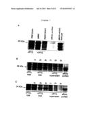 Membrane Transporter NaPi2b (SCL34A2) Epitope for Antibody Therapy,     Antibodies Directed Thereto, and Target for Cancer Therapy diagram and image