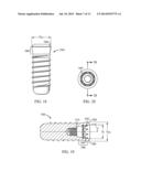 COMPONENTS FOR USE WITH IMPLANTS AND RELATED METHODS diagram and image