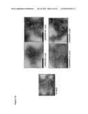 Vault Agents for Treating Chronic Kidney Disease diagram and image