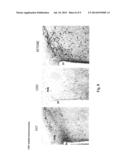 HYDROXYBUTYRATE ESTER AND MEDICAL USE THEREOF diagram and image