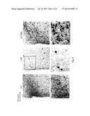 HYDROXYBUTYRATE ESTER AND MEDICAL USE THEREOF diagram and image