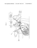 TROCAR, AND SURGERY ASSISTANCE SYSTEM diagram and image